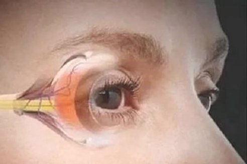 Luteina - wsparcie plamki zoltej